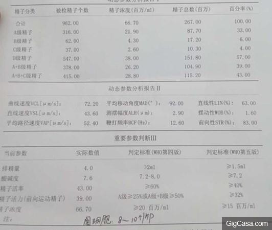 精液常規檢查攻略之你射對了嗎?